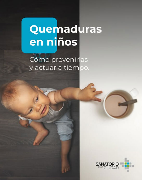 En invierno aumentan las quemaduras por líquidos calientes, estufas, y objetos al alcance de la mano.